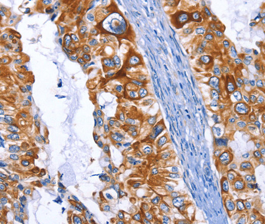 ARRB1 Polyclonal Antibody (E-AB-13940)