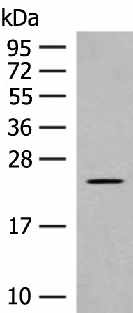 CLEC3B Polyclonal Antibody (E-AB-18795)