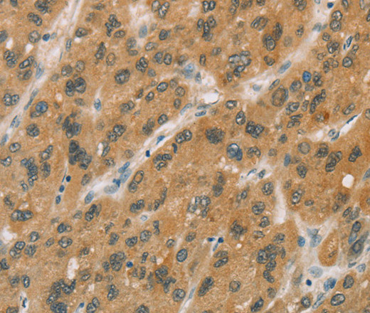 CYP11A1 Polyclonal Antibody (E-AB-14914)