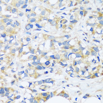 BRK1 Polyclonal Antibody (E-AB-67071)