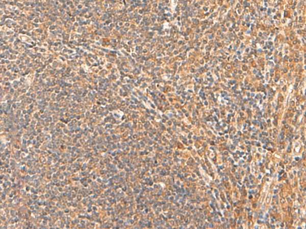 HPCA Polyclonal Antibody (E-AB-19988)
