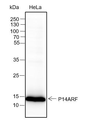 Recombinant CDKN2A/p14ARF Monoclonal Antibody (AN301615L)