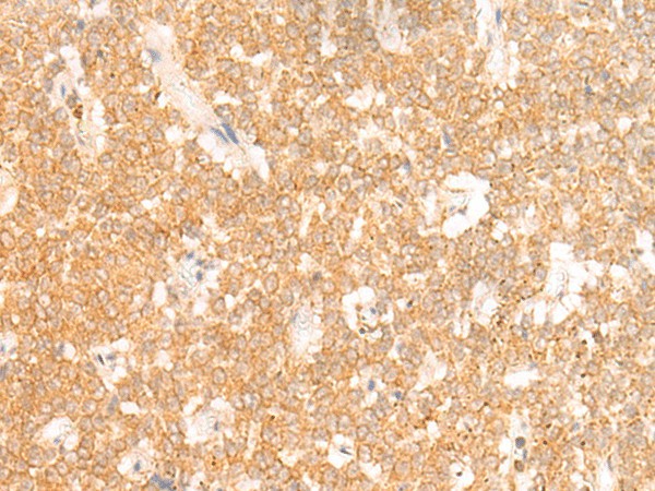 RRP8 Polyclonal Antibody (E-AB-18099)