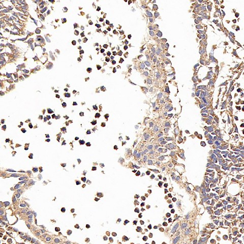 CD133 Monoclonal Antibody (E-AB-70172)