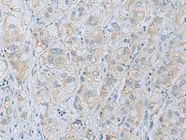 NAGK Polyclonal Antibody (E-AB-19240)