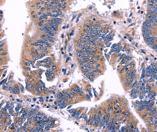 ARC Polyclonal Antibody (E-AB-10826)
