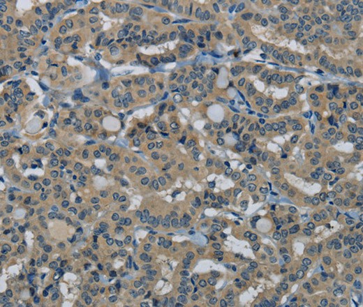 HSPG2 Polyclonal Antibody (E-AB-16704)