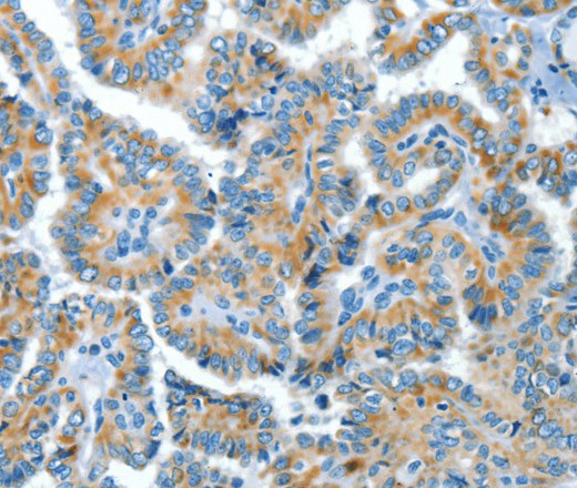 COG1 Polyclonal Antibody (E-AB-16350)