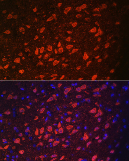 TRPM2 Polyclonal Antibody (E-AB-61822)