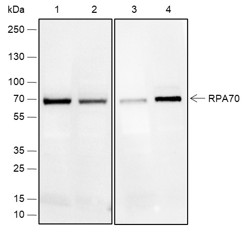 Recombinant RPA70 Monoclonal Antibody (AN301946L)