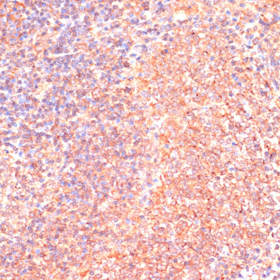IL4R Polyclonal Antibody (E-AB-66320)