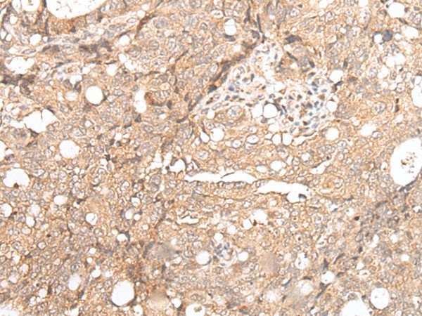 FOXO4 Polyclonal Antibody (E-AB-53430)