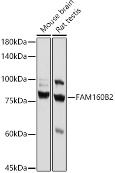 FAM160B2 Polyclonal Antibody (E-AB-92130)