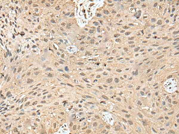 ATXN3 Polyclonal Antibody (E-AB-52456)