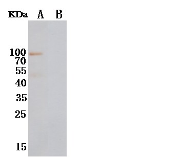NRG1-beta 1 Monoclonal Antibody (AN200087P)