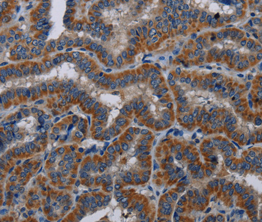 KLK11 Polyclonal Antibody (E-AB-11357)