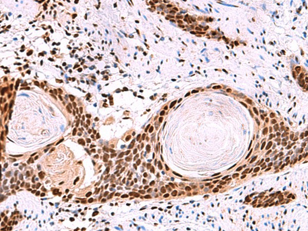 SF3B3 Polyclonal Antibody (E-AB-52936)
