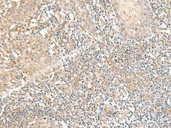 GPR157 Polyclonal Antibody (E-AB-18041)