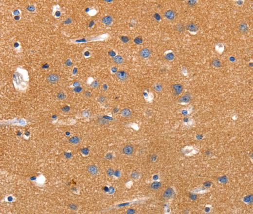 JAK2 Polyclonal Antibody (E-AB-12524)