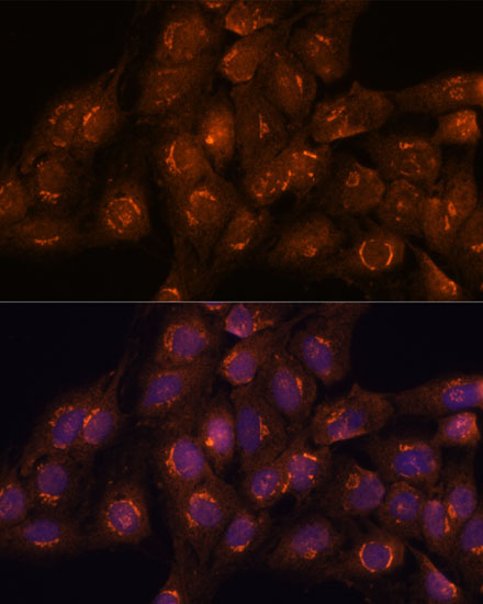 ACBD3 Polyclonal Antibody (E-AB-66858)