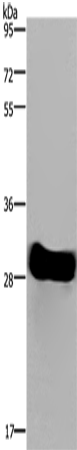 FHL2 Polyclonal Antibody (E-AB-11237)