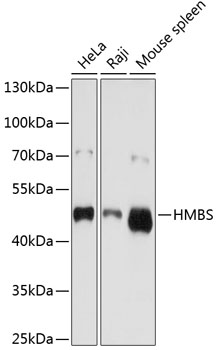 HMBS Polyclonal Antibody (E-AB-60442)