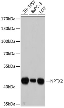 NPTX2 Polyclonal Antibody (E-AB-63610)