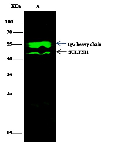 Recombinant SULT2B1 Monoclonal Antibody (AN300117P)