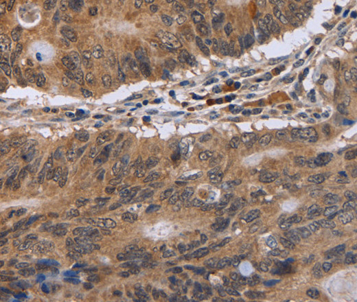 EIF3H Polyclonal Antibody (E-AB-11182)