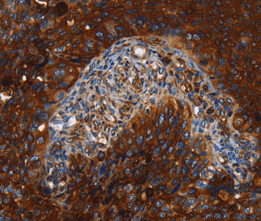 MSLN Polyclonal Antibody (E-AB-14227)