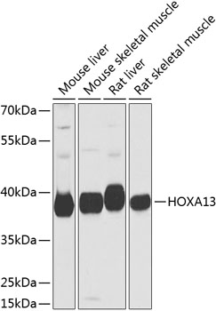 HOXA13 Polyclonal Antibody (E-AB-62097)