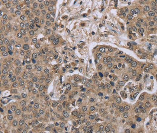 IL15RA Polyclonal Antibody (E-AB-15727)