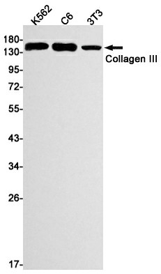 Recombinant Collagen III alpha 1 Monoclonal Antibody (E-AB-81463)