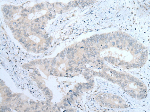 ITGA8 Polyclonal Antibody (E-AB-53512)