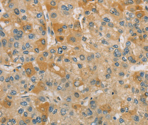 CENPF Polyclonal Antibody (E-AB-16336)