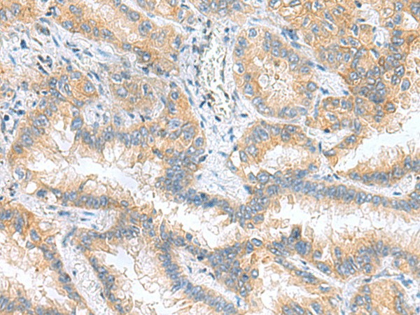 RPS16 Polyclonal Antibody (E-AB-19126)