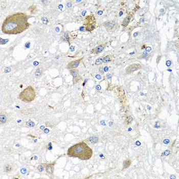 IFNL3 Polyclonal Antibody (E-AB-68293)