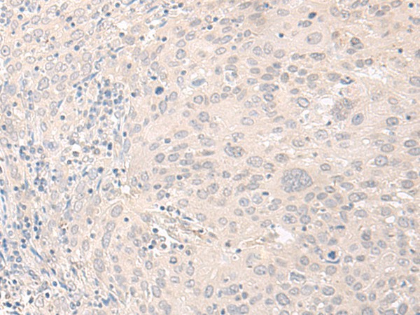 FOXRED2 Polyclonal Antibody (E-AB-18745)