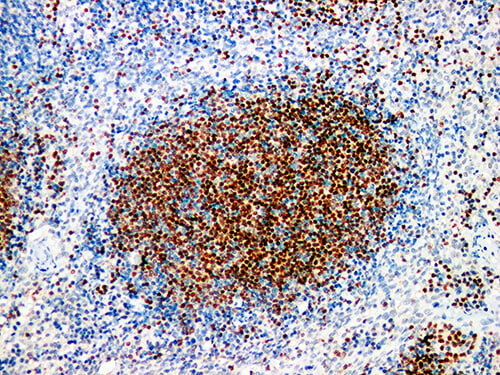 Pax-5 Monoclonal Antibody (ELAB6688-M)