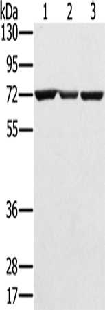 SLC25A13 Polyclonal Antibody (E-AB-11581)