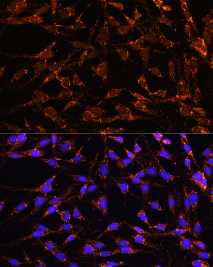 XK Polyclonal Antibody (E-AB-65201)