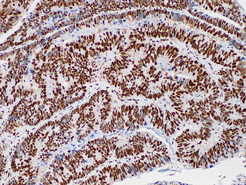 MLH1 Monoclonal Antibody (ELAB6124-M)