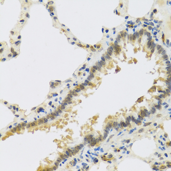 RSPO1 Polyclonal Antibody (E-AB-67973)