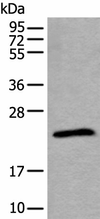 TPT1 Polyclonal Antibody (E-AB-18294)