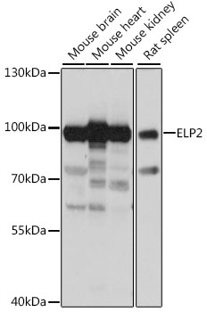 ELP2 Polyclonal Antibody (E-AB-91316)