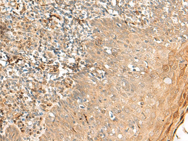 ZNF397 Polyclonal Antibody (E-AB-52726)