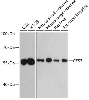 CES3 Polyclonal Antibody (E-AB-65485)