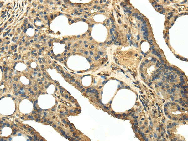 TRPC4AP Polyclonal Antibody (E-AB-17161)