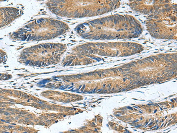 CLEC1B Polyclonal Antibody (E-AB-52143)