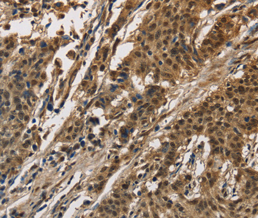 CCAR1 Polyclonal Antibody (E-AB-14953)